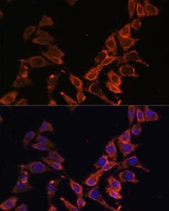 Immunofluorescence analysis of L929 cells using Anti-ND4 Antibody (A93263) at a dilution of 1:100. DAPI was used to stain the cell nuclei (blue).