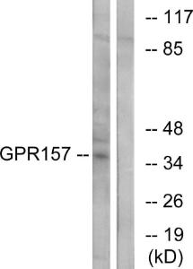 Western blot analysis of lysates from NIH/3T3 cells using Anti-GPR157 Antibody. The right hand lane represents a negative control, where the antibody is blocked by the immunising peptide.