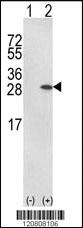 Anti-GSTP1 Rabbit Polyclonal Antibody