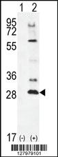 Anti-TSSK4 Rabbit Polyclonal Antibody [clone: 147CT8.3.4]