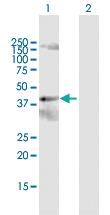 Anti-PCYT2 Rabbit Polyclonal Antibody