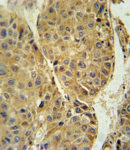 Anti-TUBB3 Rabbit Polyclonal Antibody (HRP (Horseradish Peroxidase))