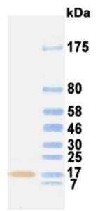 Western blotting result