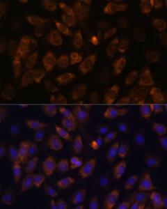 Immunofluorescence analysis of C6 cells using Anti-MT-ND4L Antibody (A93264) at a dilution of 1:100 DAPI was used to stain the cell nuclei (blue)