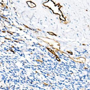 Immunohistochemistry analysis of paraffin-embedded human placenta using Anti-CD31 Antibody [ARC50362] (A305352) at a dilution of 1:600(40x lens)