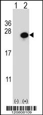 Anti-GSTP1 Rabbit Polyclonal Antibody