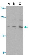 Anti-EIF4EBP1 Rabbit Polyclonal Antibody