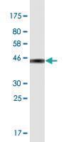 Anti-SOD1 Mouse Monoclonal Antibody [clone: 10D5]