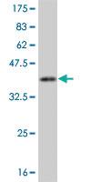 Anti-CAMK1 Mouse Monoclonal Antibody [clone: 2B6]