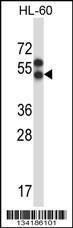 Anti-APLNR Rabbit Polyclonal Antibody (Biotin)