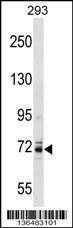 Anti-KCNC4 Rabbit Polyclonal Antibody