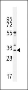 Anti-NEUROG3 Rabbit Polyclonal Antibody (HRP (Horseradish Peroxidase))