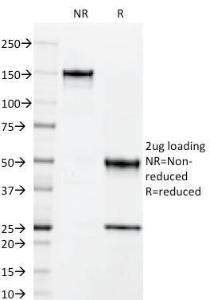 SDS-PAGE analysis of Anti-ICAM3 Antibody [101-1D2] under non-reduced and reduced conditions; showing intact IgG and intact heavy and light chains, respectively. SDS-PAGE analysis confirms the integrity and purity of the antibody