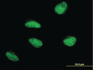 Anti-MSH5 Mouse Monoclonal Antibody [clone: 1C11]