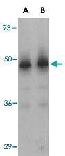 Anti-AKT1 Rabbit Polyclonal Antibody