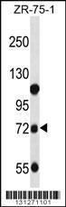 Anti-GUSB Rabbit Polyclonal Antibody (HRP (Horseradish Peroxidase))