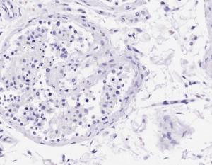 Anti-ACR Antibody (A85217) Negative Control showing staining of paraffin embedded Human Cerebellum, with no primary antibody