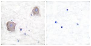 Immunohistochemical analysis of paraffin-embedded human brain tissue using Anti-mGluR4 Antibody. The right hand panel represents a negative control, where the Antibody was pre-incubated with the immunising peptide