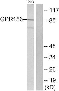 Anti-GPR156 antibody