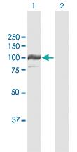 Anti-PYGL Rabbit Polyclonal Antibody