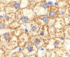 Anti-AKT1 Rabbit Polyclonal Antibody