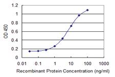 Anti-GSKIP Mouse Monoclonal Antibody [clone: 2F2]