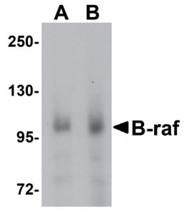 Anti-BRAF Chicken Polyclonal Antibody