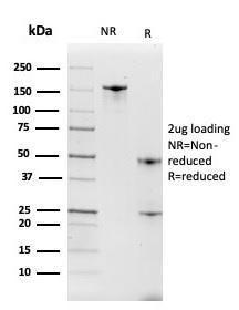 SDS-PAGE analysis of Anti-Intelectin 1 Antibody [ITLN1/4063] under non-reduced and reduced conditions; showing intact IgG and intact heavy and light chains, respectively. SDS-PAGE analysis confirms the integrity and purity of the antibody.