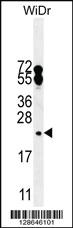 Anti-FAM96A Rabbit Polyclonal Antibody [clone: 151CT1.3.1]