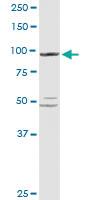 Anti-PYGL Rabbit Polyclonal Antibody