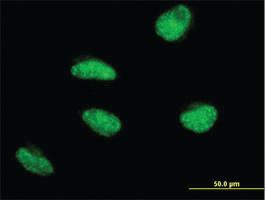 Anti-MSH5 Mouse Monoclonal Antibody [clone: 1C11]