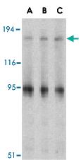 Anti-IRS1 Rabbit Polyclonal Antibody