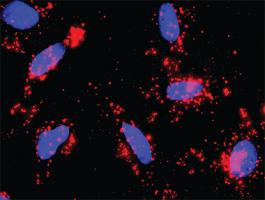 Anti-PIK3R1 + CTNNB1 Antibody Pair