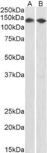 Anti-CCAR2 Antibody (A85218) (0.5µg/ml) staining of HEK293 (A) and MCF7 (B) nuclear lysates (35µg protein in RIPA buffer). Primary incubation was 1 hour. Detected by chemiluminescence.