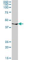 Anti-GATA1 Rabbit Polyclonal Antibody