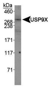 Anti-USP9X Rabbit Polyclonal Antibody