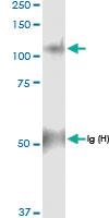 Anti-PYGL Rabbit Polyclonal Antibody