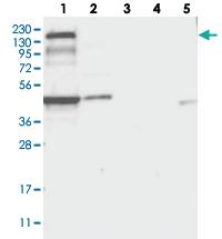 Anti-PLEKHA5 Rabbit Polyclonal Antibody