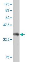 Anti-PRDM1 Mouse Polyclonal Antibody