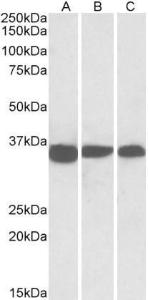 Anti-PCNA Antibody (A83563) (003 µg/ml) staining of NIH3T3 (A), Mouse Testis (B) and Rat Testis (C) lysates (35 µg protein in RIPA buffer) Primary incubation was 1 hour Detected by chemiluminescence