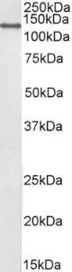 Anti-CCAR2 Antibody (A85218) (2µg/ml) staining of NIH3T3 nuclear lysates (35µg protein in RIPA buffer). Primary incubation was 1 hour. Detected by chemiluminescence.