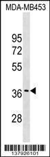 Anti-GJC3 Rabbit Polyclonal Antibody (PE (Phycoerythrin))