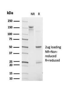 SDS-PAGE analysis of Anti-IRF9 Antibody [PCRP-IRF9-2F8] under non-reduced and reduced conditions; showing intact IgG and intact heavy and light chains, respectively. SDS-PAGE analysis confirms the integrity and purity of the antibody.