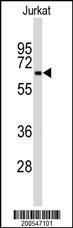 Anti-BECN1 Mouse Monoclonal Antibody [clone: 117CT2.5.1.1]