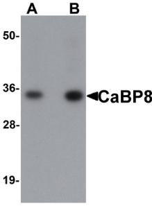 Anti-CALN1 Rabbit Polyclonal Antibody