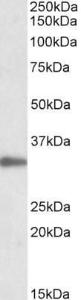 Anti-PCNA Antibody (A83563) (005 µg/ml) staining of Jurkat lysate (35 µg protein in RIPA buffer) Primary incubation was 1 hour Detected by chemiluminescence