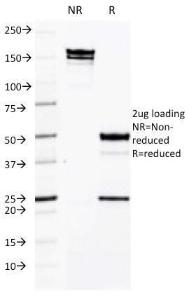 SDS-PAGE analysis of Anti-ICAM3 Antibody [CG106] under non-reduced and reduced conditions; showing intact IgG and intact heavy and light chains, respectively. SDS-PAGE analysis confirms the integrity and purity of the antibody.