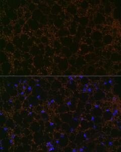 Immunofluorescence analysis of rat fat using Anti-Perilipin-1 Antibody [ARC1122] (A306256) at a dilution of 1:100 (40X lens). DAPI was used to stain the cell nuclei (blue)