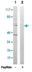 Anti-APBA3 Rabbit Polyclonal Antibody