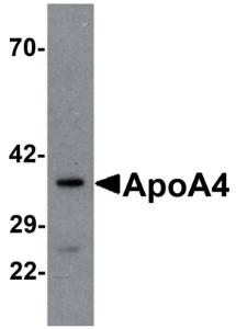 Anti-APOA4 Rabbit Polyclonal Antibody